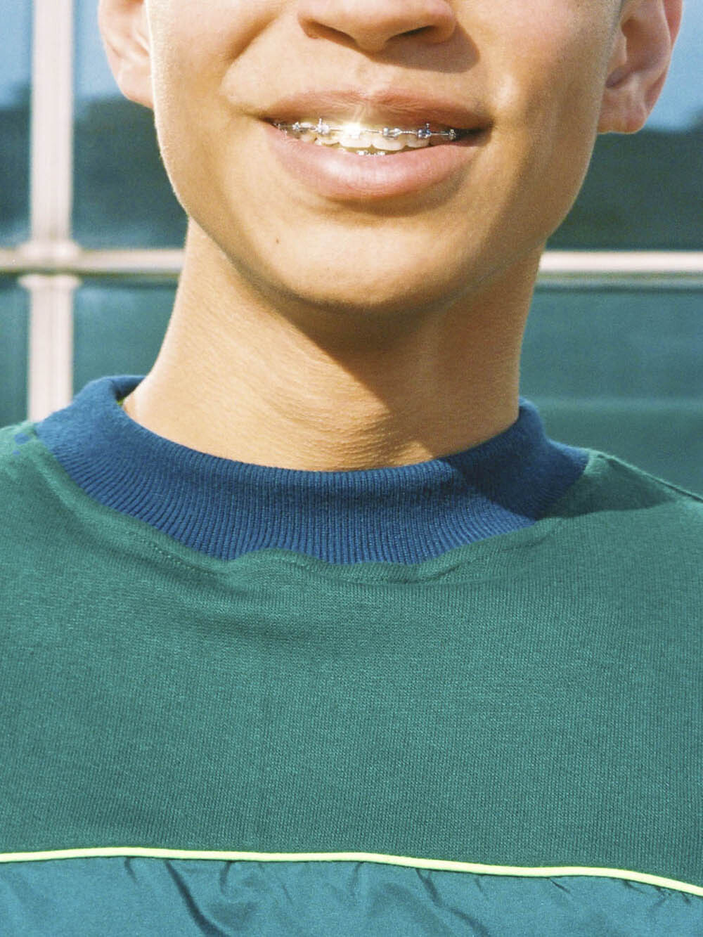Remi Ferrante