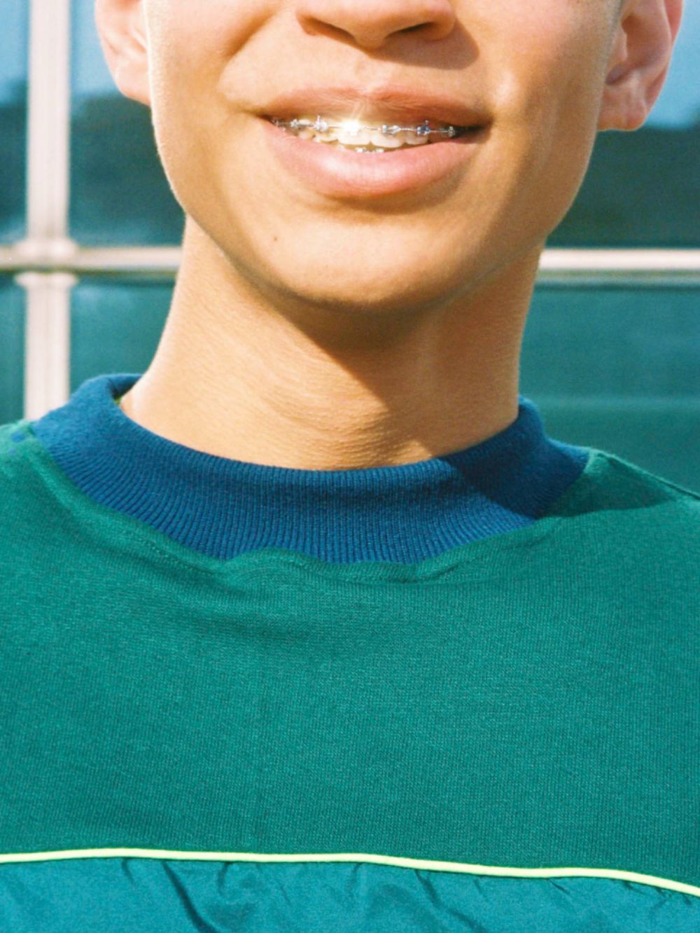 Remi Ferrante